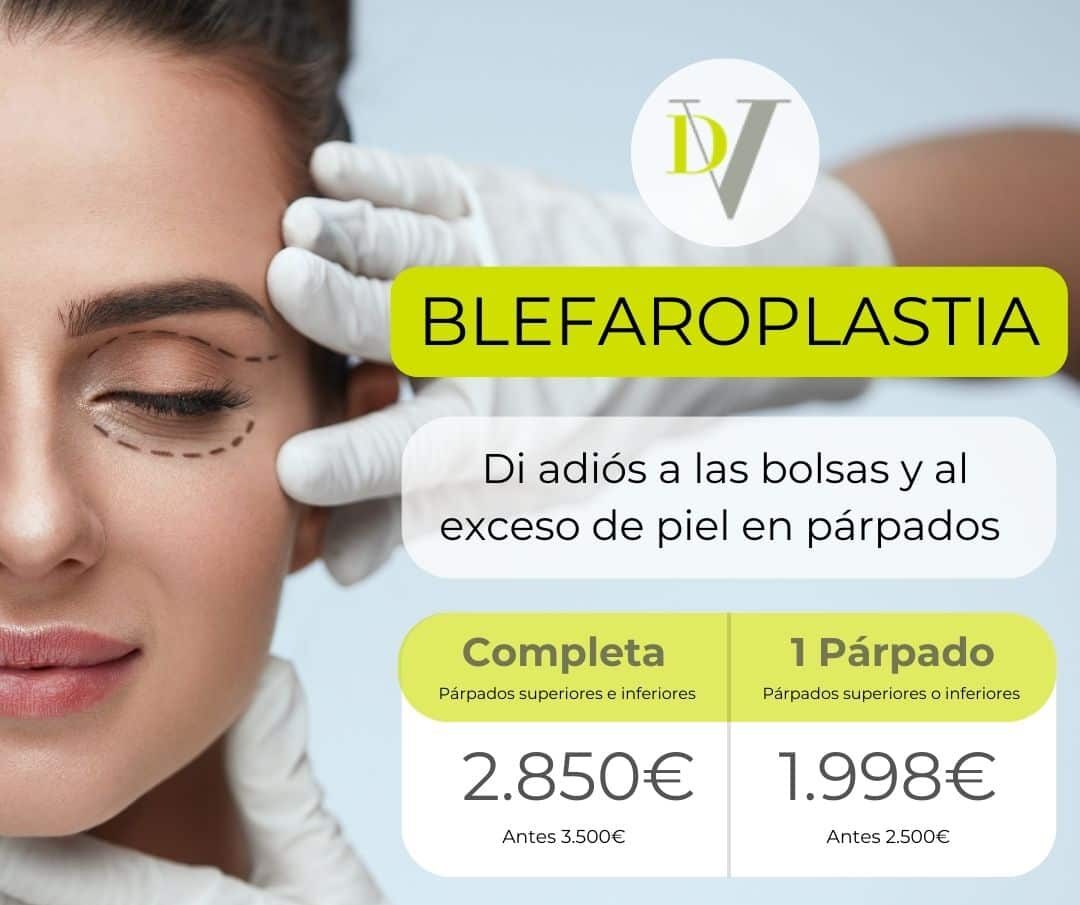 Blefaroplastia