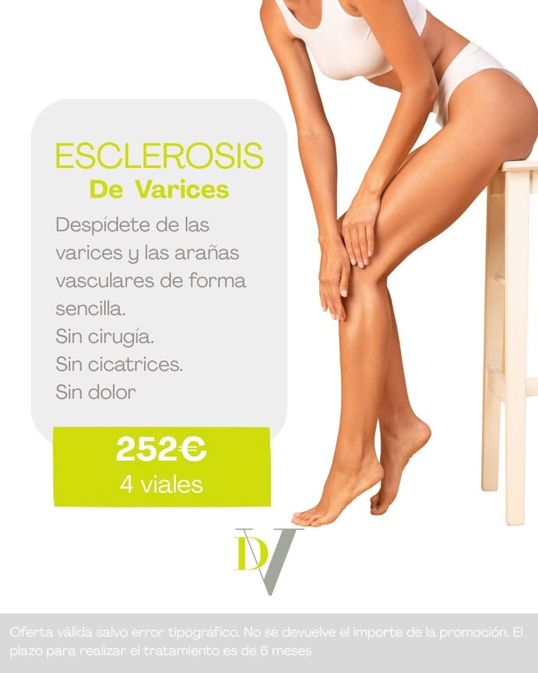 Esclerosis de Varices